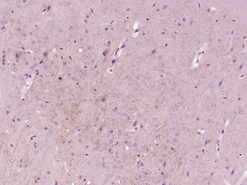 Phospho-GluR1 (Ser645) Rabbit Polyclonal Antibody