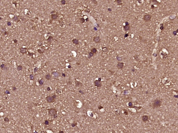 Phospho-GluR1 (Ser863) Rabbit Polyclonal Antibody