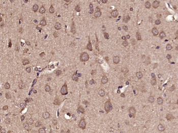 Phospho-GluR1 (Ser863) Rabbit Polyclonal Antibody