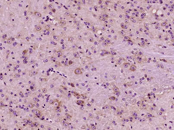 GluR1 Rabbit Polyclonal Antibody
