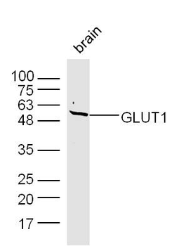 GLUT1 Rabbit Polyclonal Antibody