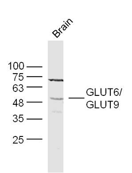 GLUT6 Rabbit Polyclonal Antibody