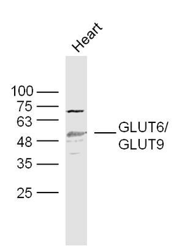 GLUT6 Rabbit Polyclonal Antibody