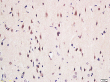 GLUT6 Rabbit Polyclonal Antibody