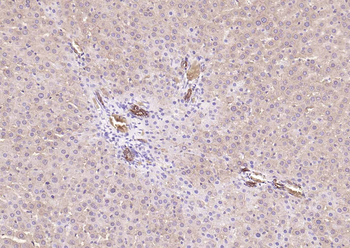 Pan Cytokeratin Mouse Monoclonal Antibody