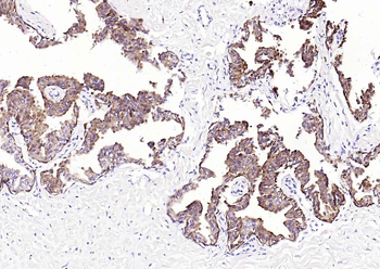 Pan Cytokeratin Mouse Monoclonal Antibody