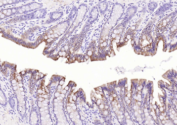 Pan Cytokeratin Mouse Monoclonal Antibody