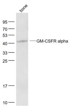 GM-CSFR alpha Rabbit Polyclonal Antibody