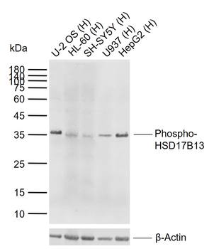 Phospho-HSD17B13 (Ser33) Rabbit Polyclonal Antibody