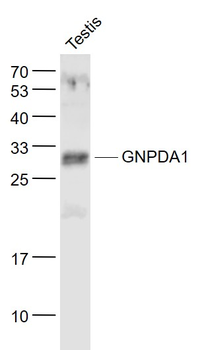 GNPDA1 Rabbit Polyclonal Antibody