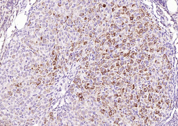 PTPN11 Rabbit Polyclonal Antibody