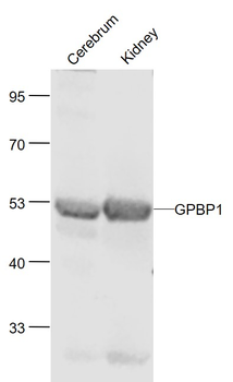GPBP1 Rabbit Polyclonal Antibody