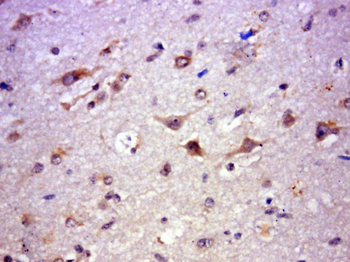 GPR84 Rabbit Polyclonal Antibody