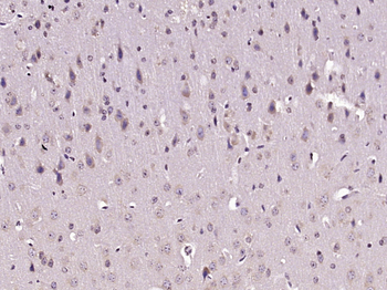 GPI Rabbit Polyclonal Antibody