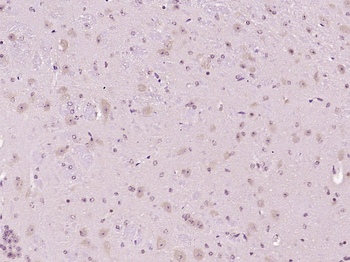 NPFF1 Receptor Rabbit Polyclonal Antibody