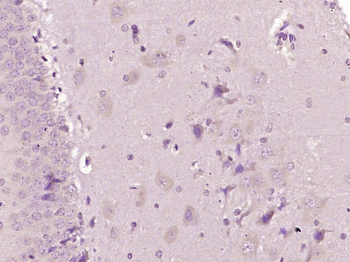 NPFF1 Receptor Rabbit Polyclonal Antibody