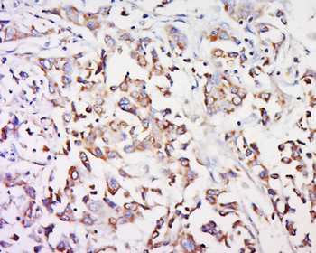GPR91 Rabbit Polyclonal Antibody