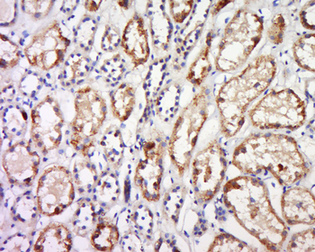 GPR91 Rabbit Polyclonal Antibody