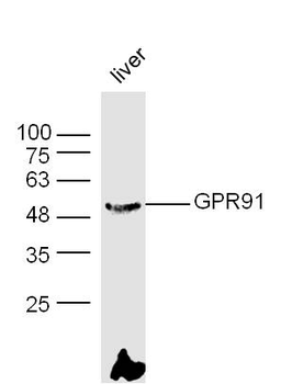 GPR91 Rabbit Polyclonal Antibody