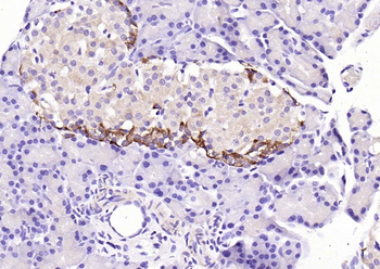 GSK3 Alpha + Beta Rabbit Polyclonal Antibody