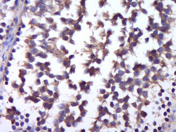 GSK3 Alpha + Beta Rabbit Polyclonal Antibody