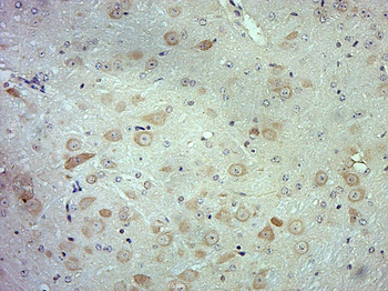 GSTA1 Rabbit Polyclonal Antibody