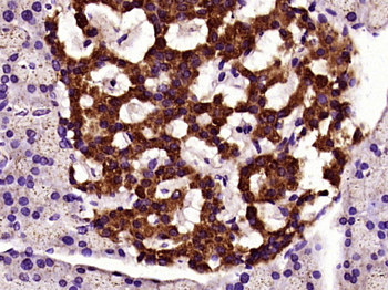 HADHSC Rabbit Polyclonal Antibody