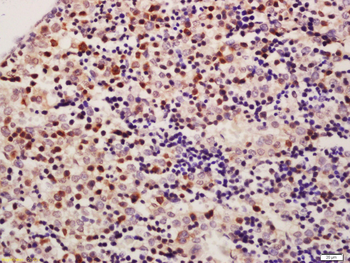 HADHSC Rabbit Polyclonal Antibody