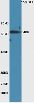 HAS2 Rabbit Polyclonal Antibody