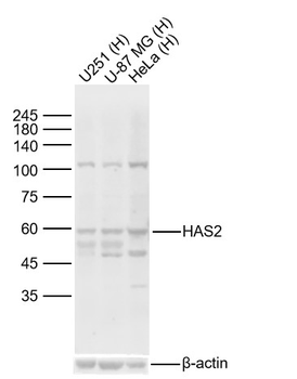 HAS2 Rabbit Polyclonal Antibody