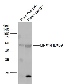 MNX1/HLXB9 Rabbit Polyclonal Antibody