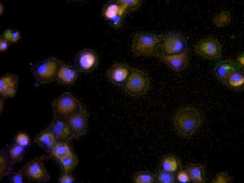 HBcAg Rabbit Polyclonal Antibody