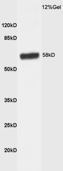 HBP1 Rabbit Polyclonal Antibody