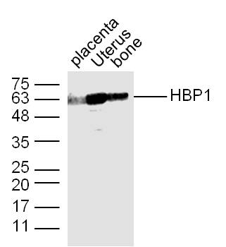 HBP1 Rabbit Polyclonal Antibody