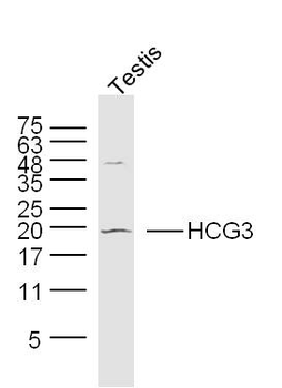 HCG3 Rabbit Polyclonal Antibody