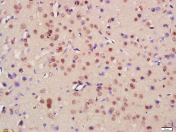 HDAC3 Rabbit Polyclonal Antibody