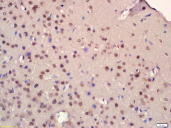 HDAC3 Rabbit Polyclonal Antibody