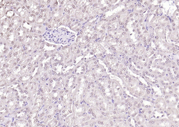 HDAC3 Rabbit Polyclonal Antibody