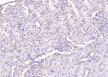 HDAC3 Rabbit Polyclonal Antibody