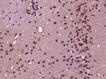 Phospho-HDAC4 (Ser632) Rabbit Polyclonal Antibody