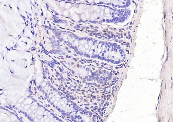 Phospho-HDAC5 (Ser259) Rabbit Polyclonal Antibody