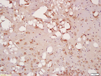 Phospho-HDAC5 (Ser259) Rabbit Polyclonal Antibody