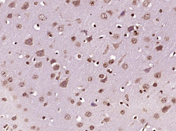 Phospho-HDAC5 (Ser498) Rabbit Polyclonal Antibody