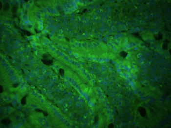 CXCL16 Rabbit Polyclonal Antibody (BF488)