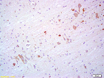 HECW1 Rabbit Polyclonal Antibody