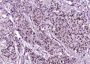 Phospho-HER2 (Tyr1222) Rabbit Polyclonal Antibody