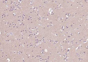 CD90/Thy-1 Mouse Monoclonal Antibody