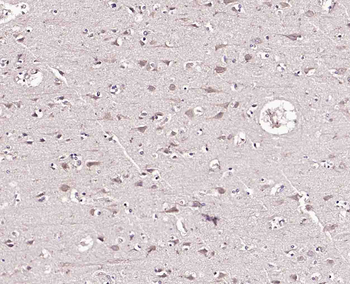 Phospho-HER4 (Tyr1056) Rabbit Polyclonal Antibody
