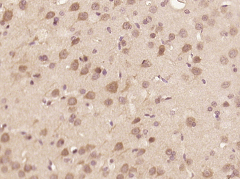 Phospho-HER4 (Tyr1056) Rabbit Polyclonal Antibody