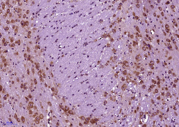 ErbB4 Rabbit Polyclonal Antibody